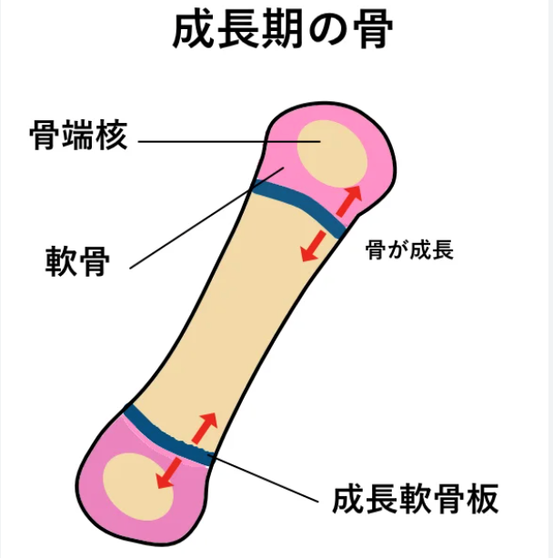 骨端核 シェーマ